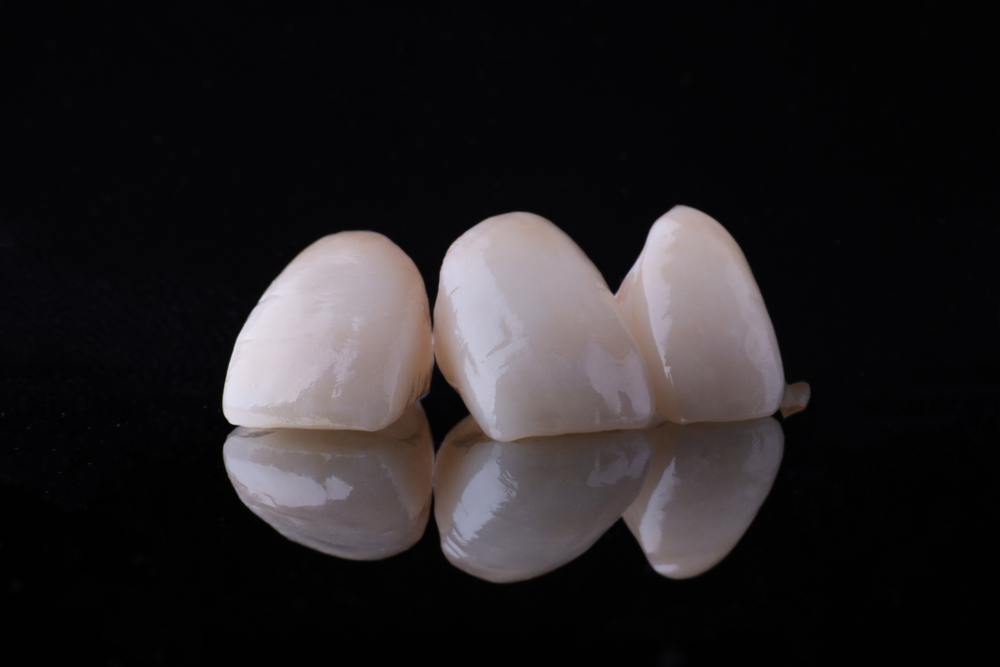 Dental Crowns Explained: What, Why, & How? Z Dentistry