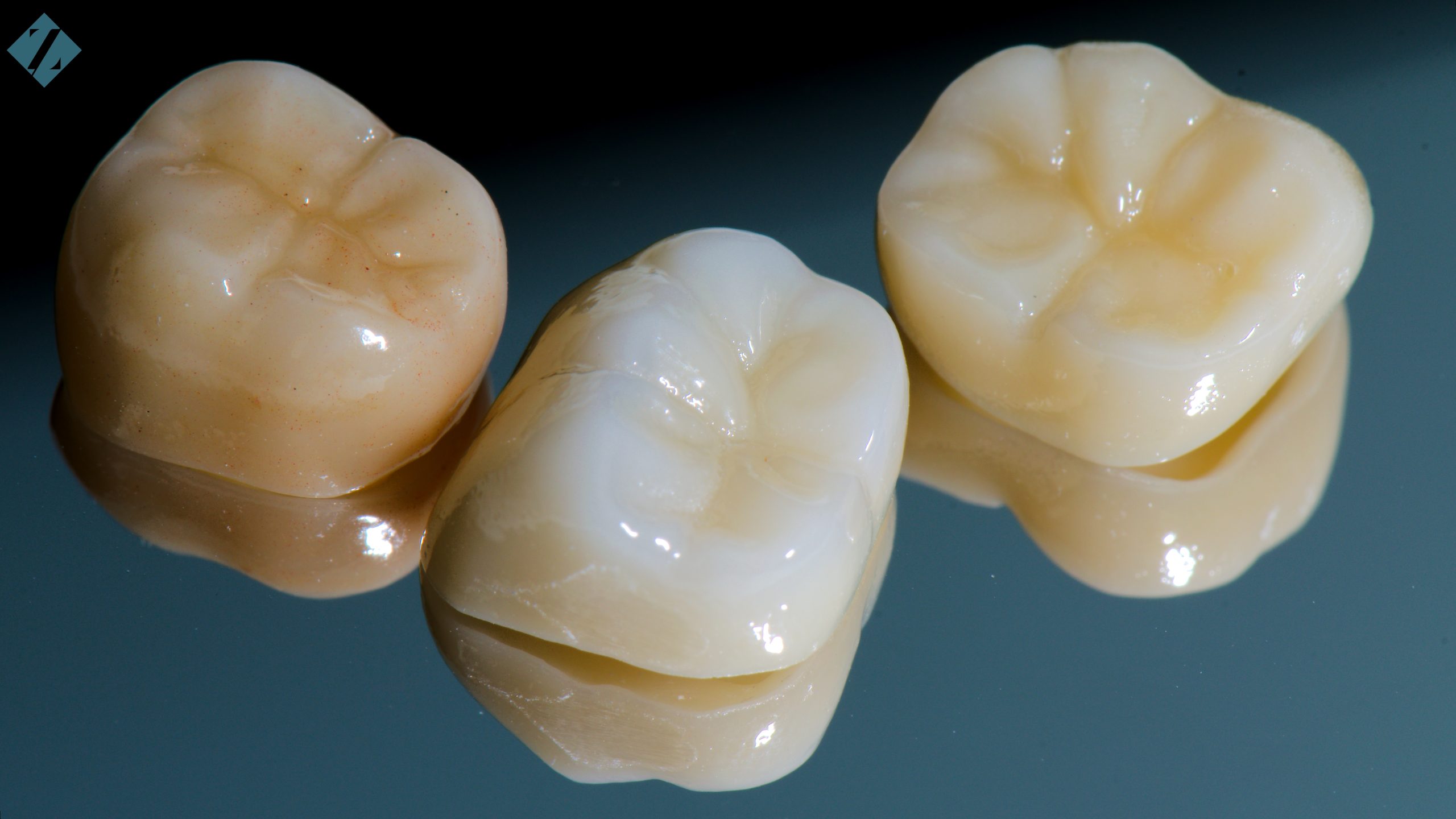 Dental Crowns, Z Dentistry, Roanoke, TX