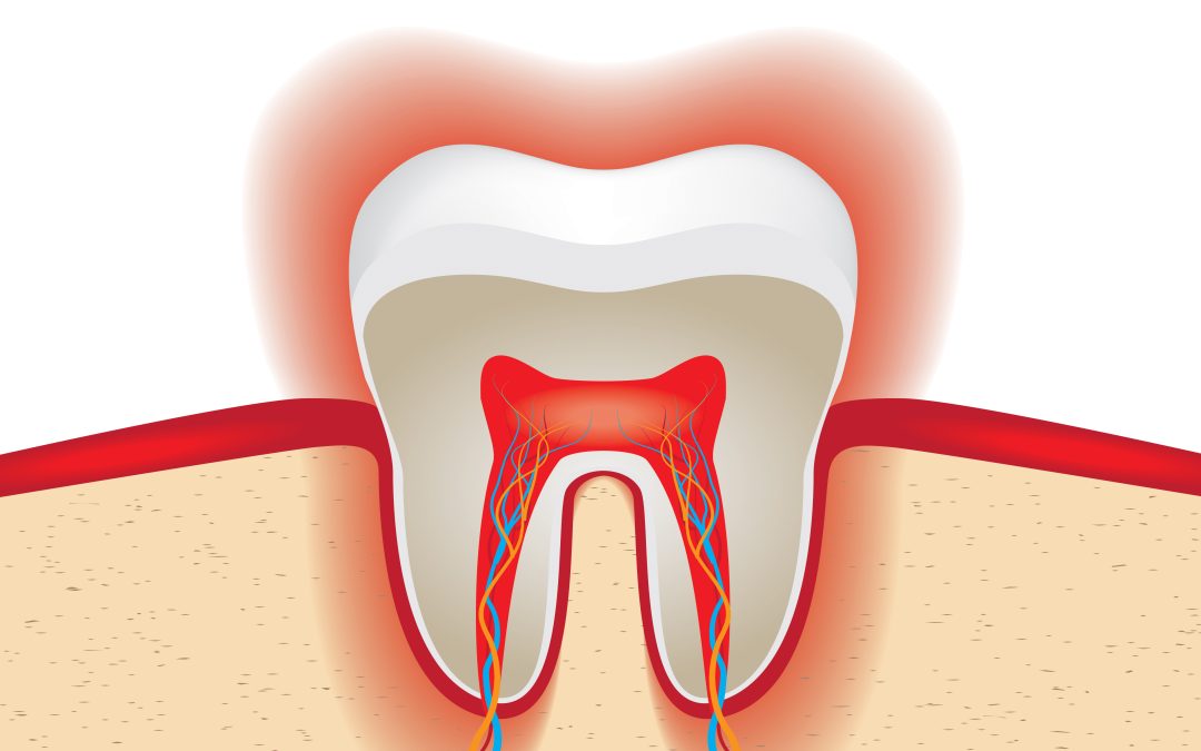 Dental Care Options for Sensitive Teeth
